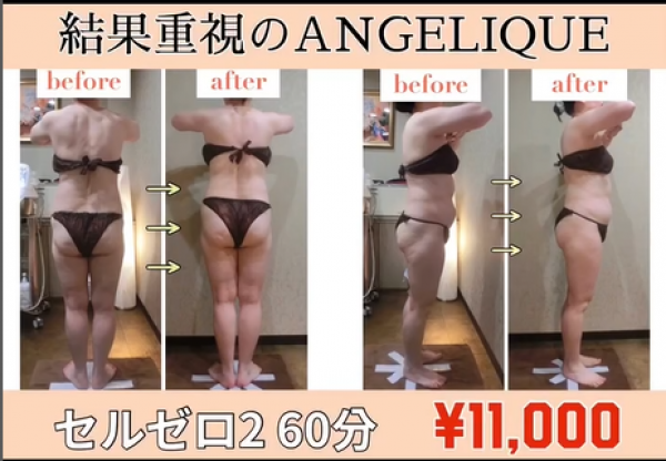 がんばっても痩せない方アンジェリークにお任せ下さい！！サムネイル