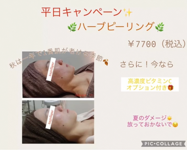 平日限定！！むけないハーブピーリングREVI半額キャンペーン中サムネイル