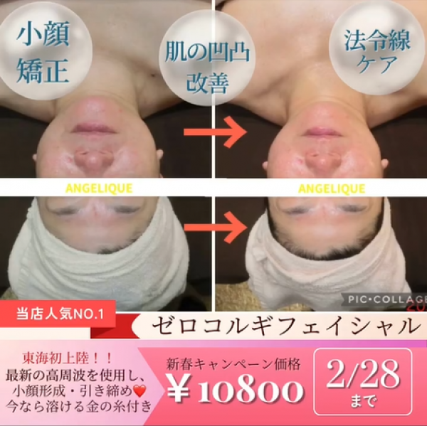 小顔矯正ゼロコルギフェイシャルサムネイル