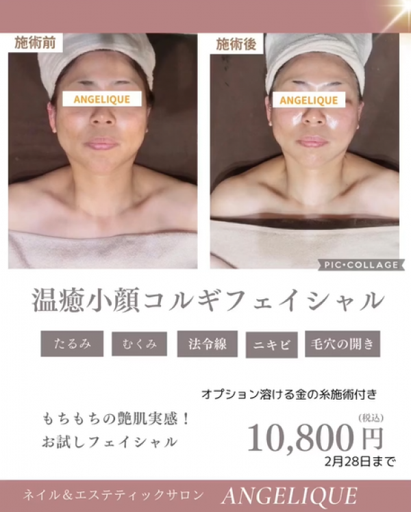 40代以降の支持率ナンバーワン！！小顔だけじゃない若返り！！サムネイル